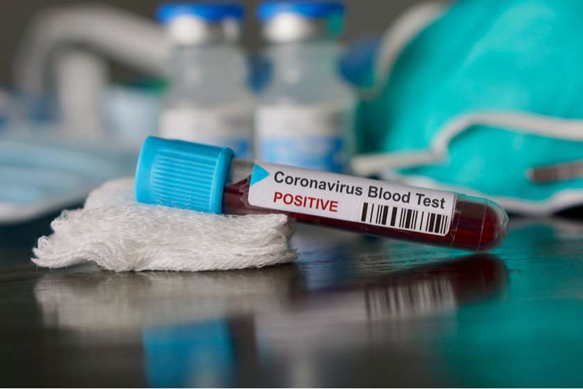 საქართველოში კორონავირუსით ინფიცირებული 482 პაციენტის მდგომარეობა მძიმეა