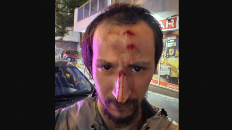 2026/08/09/c4dnhuq5x6ayd0f.png